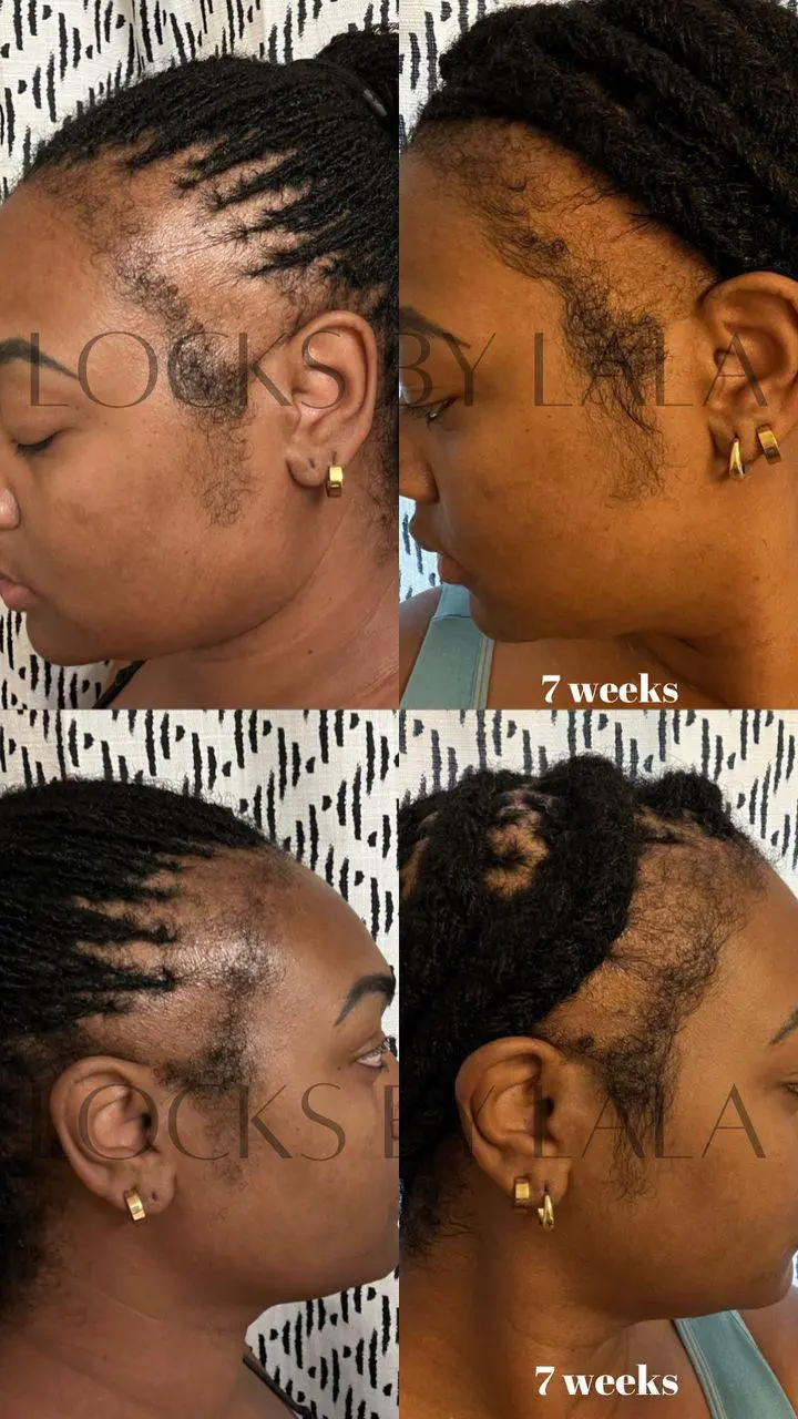 Mega Edge & Hair Growth Grease - Image 13