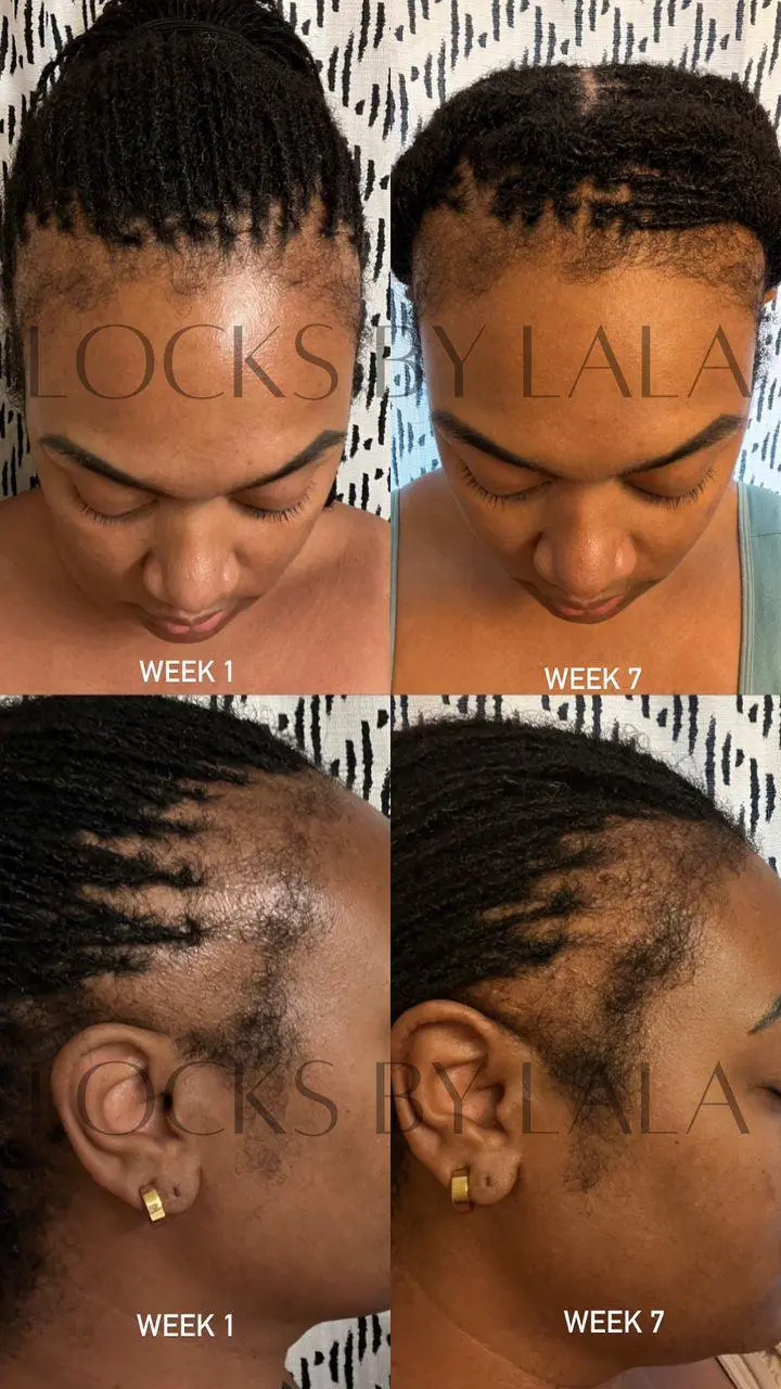 Mega Edge & Hair Growth Grease - Image 14