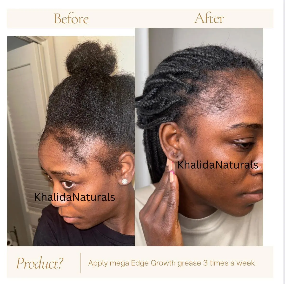 Mega Edge & Hair Growth Grease - Image 15