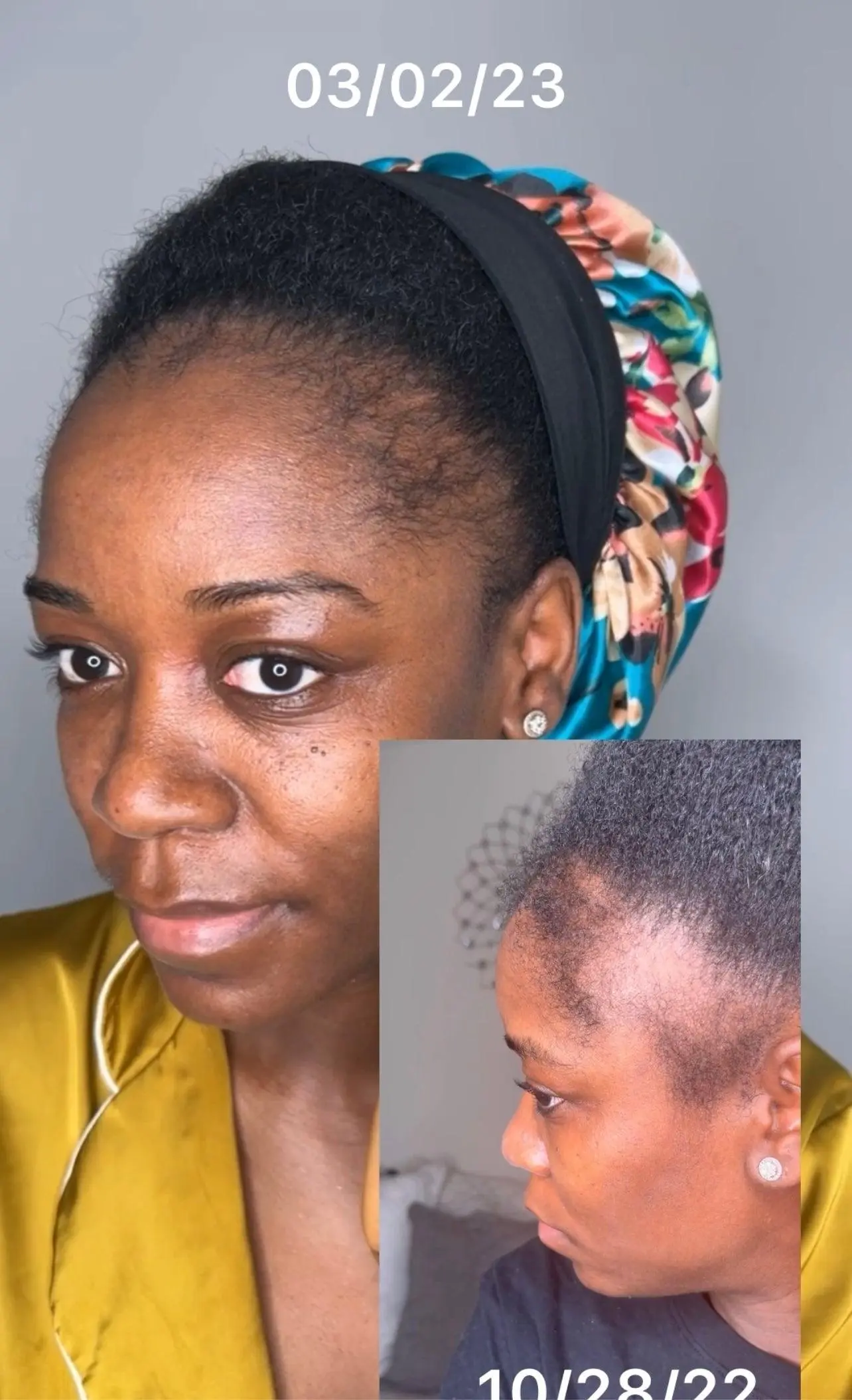 Mega Edge & Hair Growth Grease - Image 7