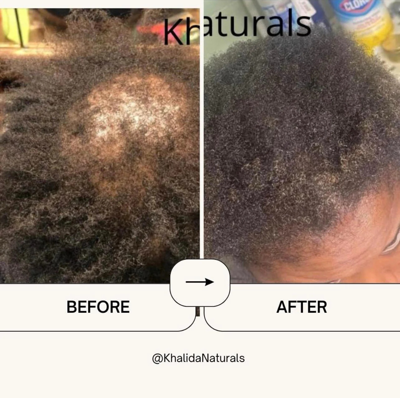 Kinky Hair Growth Oil(West African Batana Oil) - Image 3